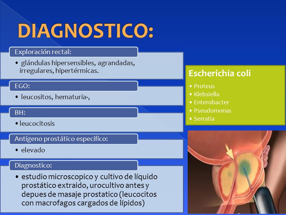 urocultivo después del masaje de próstata urocultivo después del masaje de próstata